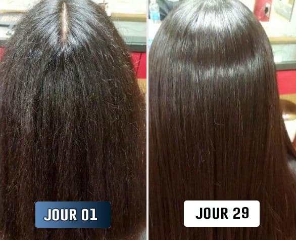 Hazel W., avant/après