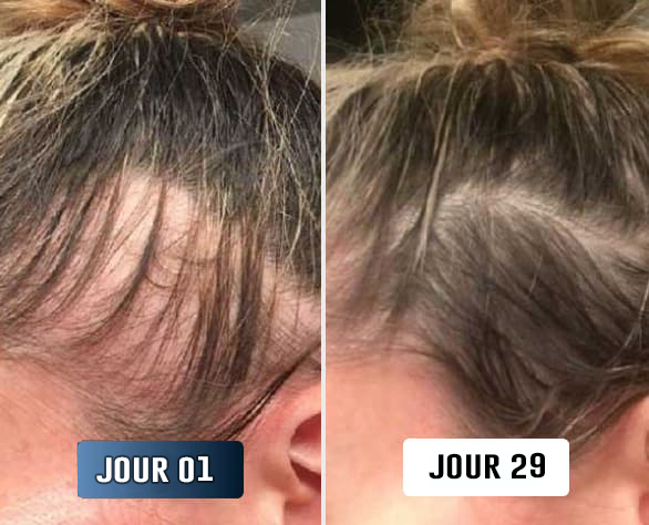 Jocelyne U., avant/après