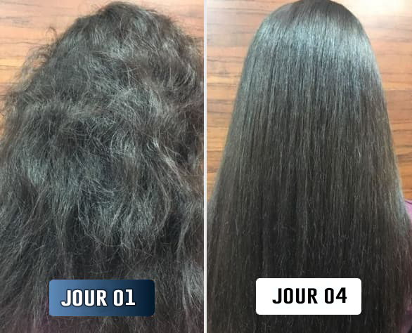 Talia N., avant/après