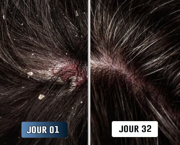 Naomi D., avant/après