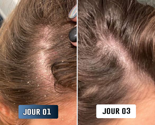 Uma F., avant/après